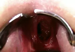 Kinkynikky Prolaps XO specul anal video six gay